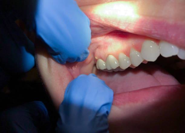 Best Emergency Treatment for Jaw Pain or Injury in Armada, MI