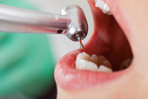 Best Emergency Care for Gum Disease in Armada, MI